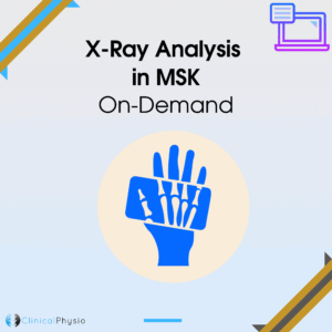 X-Ray Analysis in MSK On-Demand Webinar