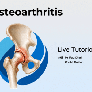 Hip Osteoarthritis LIVE Tutorial