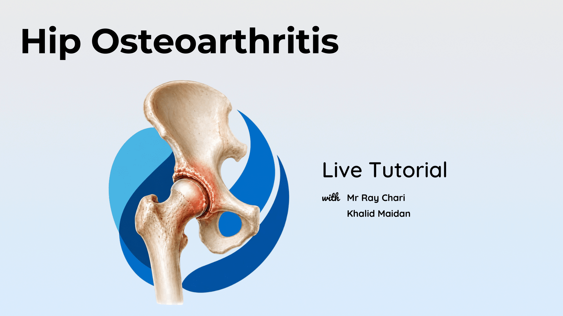 Hip Osteoarthritis LIVE Tutorial
